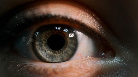 Ophthalmic imaging